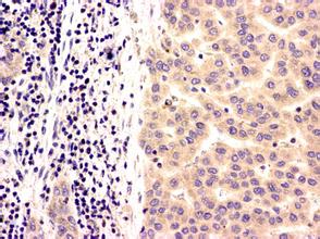 首页| 和记H88集团怡情博娱官网