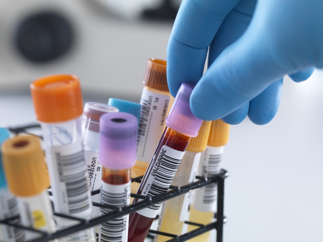 “溶出”还是“BE”，何为临床疗效“金尺度”