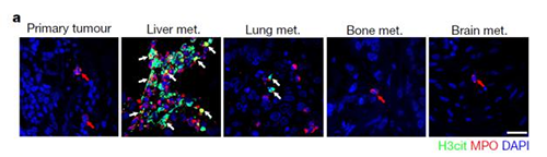 转入幼鼠模型得到一样的试验了局，且在转移产生前NET已在肝脏聚积。