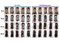 “世纪难题”脱发的医治迎来新曙光