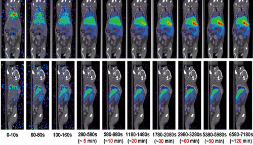 和记H88PET/CT分子影像技术平台