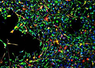 世界初创：药物将干细胞疏导至受损部位，提高其愈合能力！