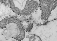 急剧血液检测可鉴别沉症高风险COVID-19患者