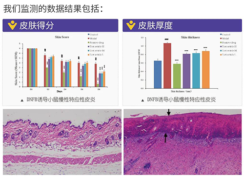和记H88成立的特应性皮炎及湿疹模型监测数据了局