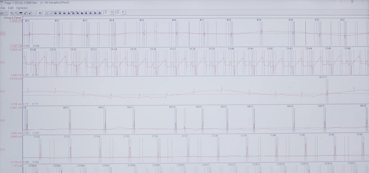 和记H88 SEND 数据转换平台