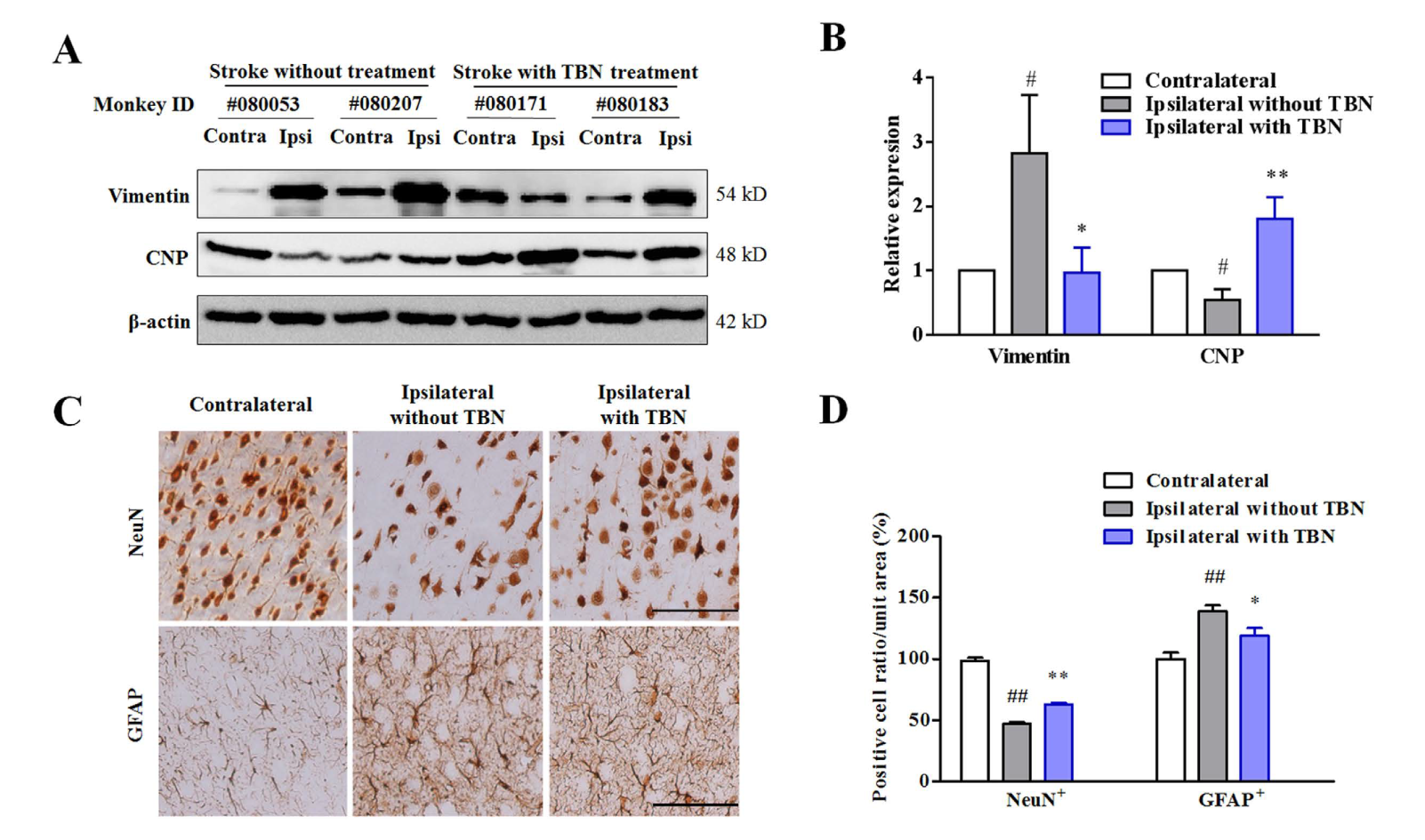 TBN是一种医治缺血性卒中的新型临床候选药物，本钻研中TBN通过和记H88合成